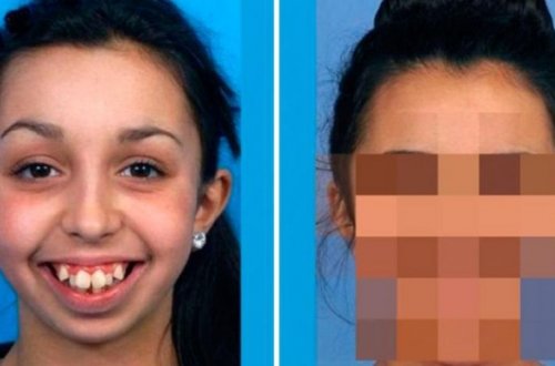 Özünü eybəcər sayan qız o qədər dəyişdi ki... FOTOLAR