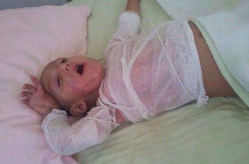 SƏHİYYƏDƏ BİABIRÇILIQ: Uşağı yanan ana fəryad edir — 5 saylı xəstəxanada RƏZALƏT