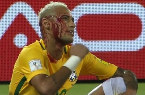 300-cü qolunu vuran Neymar qana bulandı - VİDEO