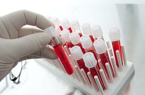 Nikaha daxil olmaq istəyən 3587 nəfərdə talassemiya xəstəliyi aşkarlanıb