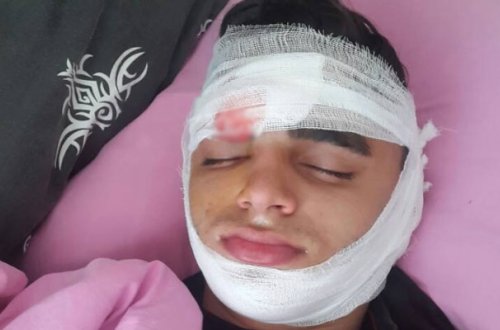 Bakıda 17 yaşlı oğlan qız üstündə ölümcül döyüldü - Foto