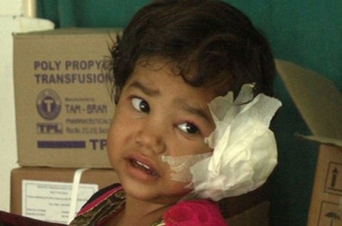 Körpənin qulağından çıxanlar həkimləri ŞOK ETDİ - FOTO