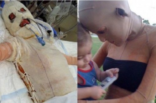 Gözəlliyinə görə üstünə spirt töküb yandırdılar - FOTOLAR