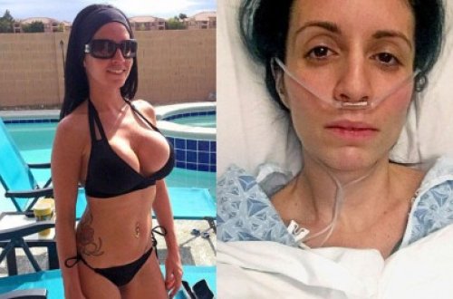 Sinəsinin cazibədar olmasını istəyən qadının 