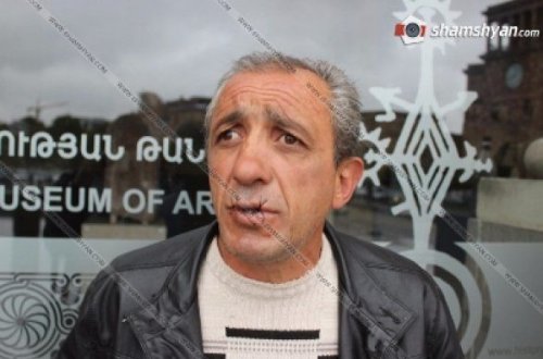 Ermənistanda vətəndaş etiraz olaraq ağzını tikdi - FOTO