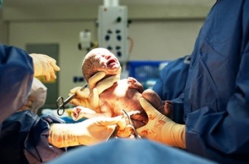 Ana ölümlərinin səbəbləri açıqlandı