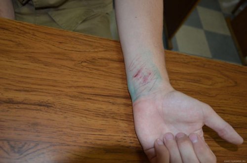 Bakıda oğlan sevdiyi qıza görə damarlarını kəsdi