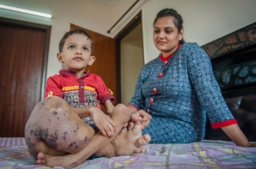 3 yaşlı körpəni görənlər şokda - FOTOLAR