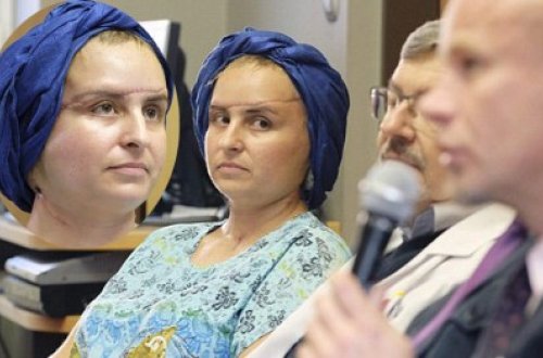 Qadının üzünü dəyişdilər - UNİKAL ƏMƏLİYYAT - FOTOLAR