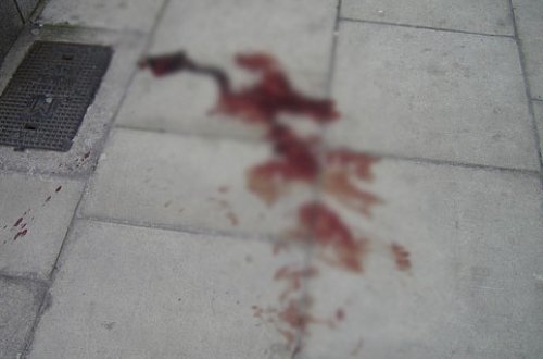 Polis idarəsində özünə amansız işgəncə verdi