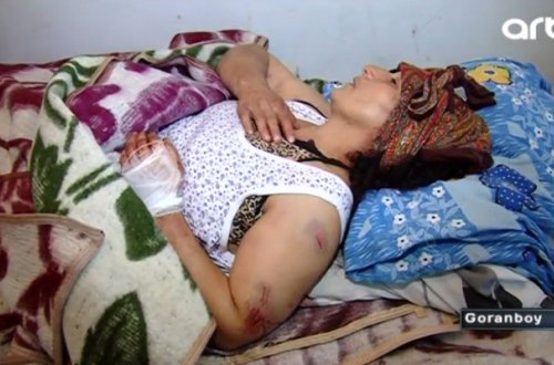 Kişi sevgilisini dəmirlə döyüb - Goranboyda + Video