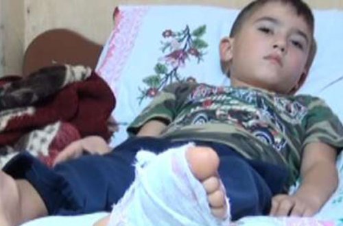 Şamaxıda əməliyyat olunan uşağın ayağında iynə qalıb - Video