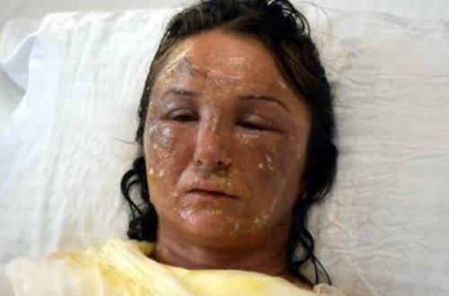 Qayınana gəlinin üzünü yandırdı - Ürəyi zəif olanlar baxmasın! - FOTO+VİDEO