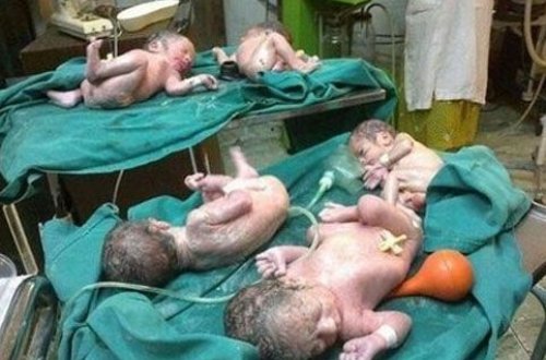 Azərbaycanda şok hadisə- 5 uşaq dünyaya gətirdi