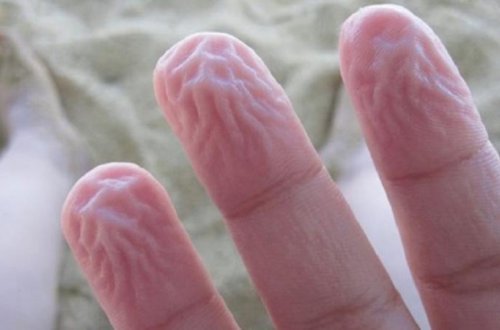 İnsanı qoruyan 9 qəribə hal - FOTOLAR