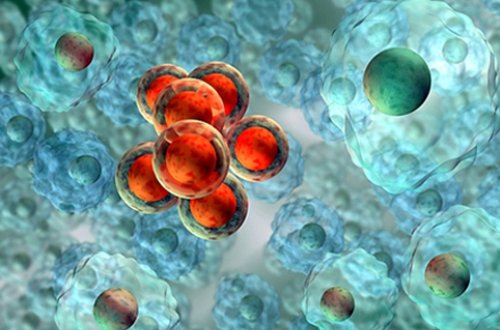 Xərçəngə qarşı mübarizə kökündən səhv gedirmiş