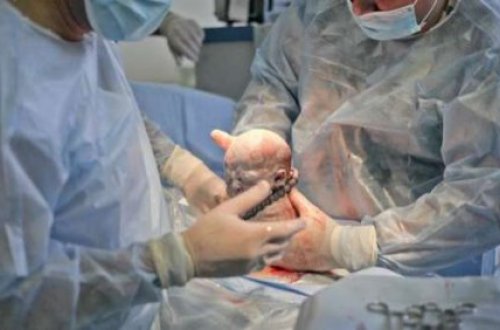 Lənkəranda qorxunc olay - Həkim-qəssabdan ölkəni şoka salan doğuş əməliyyatı...