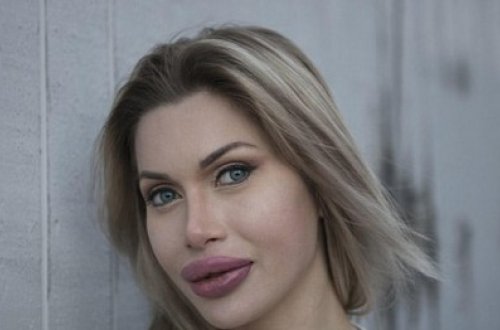 100 dəfə əməliyyat olunmuş qadın: 