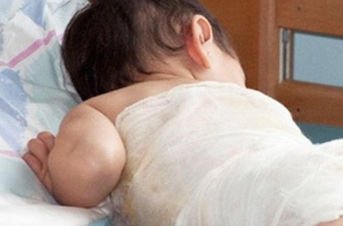 3 yaşlı uşağın qolu ətçəkən maşında qaldı