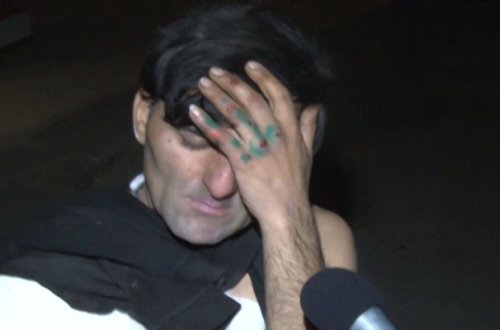 Maştağada “Ceylo”nu maşın vurdu - Foto