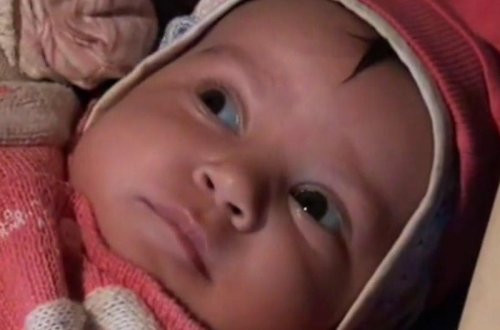 Azərbaycanda həkim səhlənkarlığı - 2 aylıq körpə kor oldu + Video