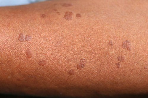 DİQQƏT! Sağ qolunuzda 11 xal varsa... - FOTOLAR