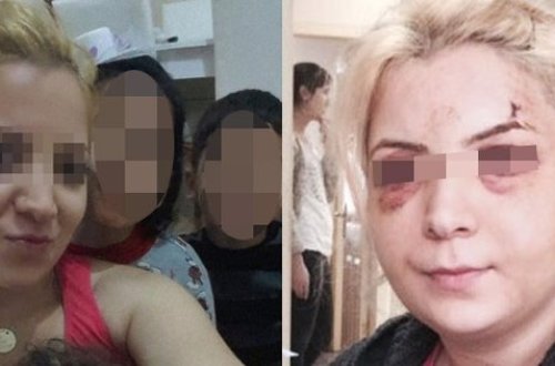 Dövlət televiziyasında BİABIRÇILIQ: 