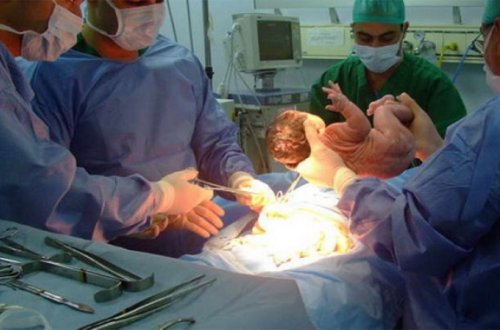 Son 25 ildə Azərbaycanda nə qədər ana ölümü baş verib?