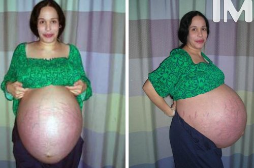 Bu qadının indiki halı görənləri şoka salır - FOTOLAR