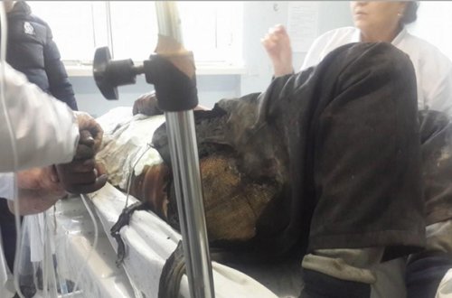 Bakıda 37 yaşlı kişi özünü yandırdı