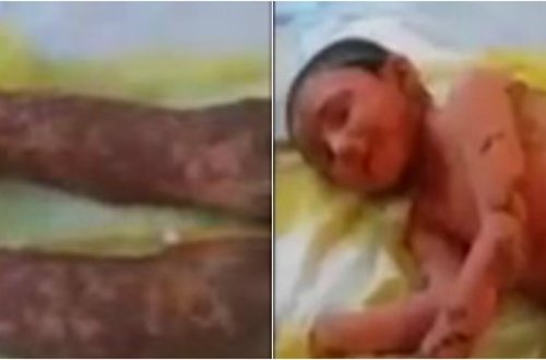 SƏHİYYƏDƏ NÖVBƏTİ BİABIRÇILIQ: YALANDAN PEDİATRAM DEYİB UŞAĞI BU HALA SALDI (+18 VİDEO)