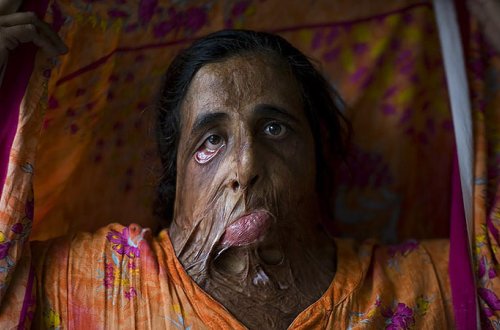 6 yaşında ərə verilən, cinsi münasibətə “yox” dediyi üçün... - DƏHŞƏTLİ QANUNLAR