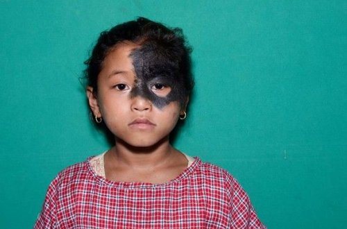 Bu uşağı görənlər dəhşətə gəlir - FOTOLAR