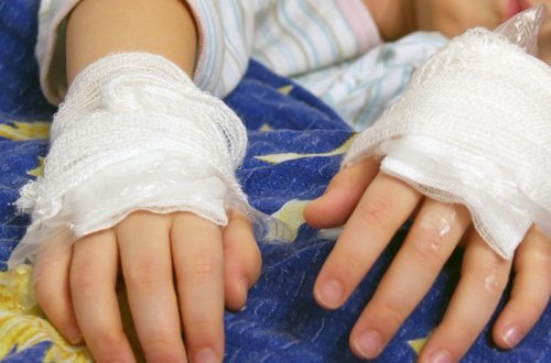 Türkiyədə PARTLAYIŞ: 1 uşaq yaralandı