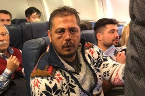 Kiyevdə ukranlar türk azarkeşlərə hücum etdi — yaralılar var + FOTOLAR