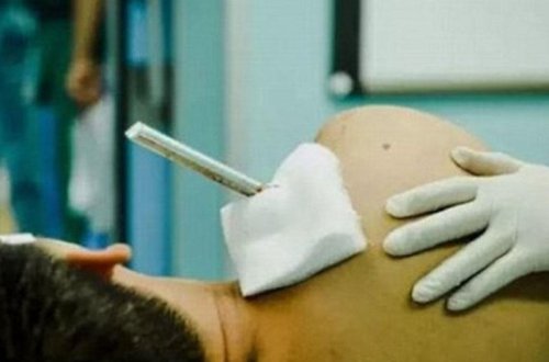 Armatur fəhlənin çiynindən girib belindən çıxsa da, sağ qaldı