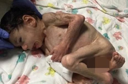 7 yaşlı 3 kiloluq uşağı belə xilas etdilər - DÜNYA BU OLAYDAN DANIŞIR+FOTOLAR