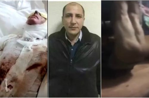 Azərbaycanlı gəlinin üstünə kislota tökdülər, dayısını soyundurub... VİDEO - FOTOLAR(+18 )