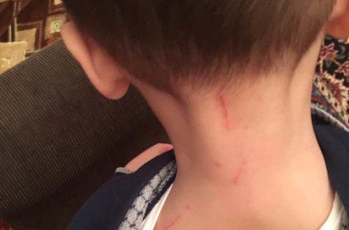 Bakıdakı uşaq bağçasında azyaşlıya qarşı VƏHŞİLİK - FOTO