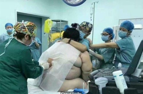 127 kq-lıq qadının doğuş zamanı çəkilən görüntüləri yayıldı - FOTOLAR