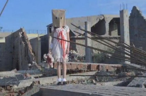 “Yaralı Hələb uşaqları