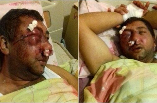 Bakıda DƏHŞƏT! Bacımı boşasan, başını kəsərəm dedi, kürəkənini belə günə qoydu (+18 FOTOLAR)