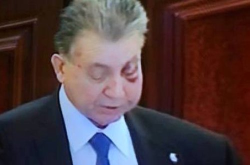 AMEA prezidentinin gözü niyə bu günə düşüb?-FOTOLAR