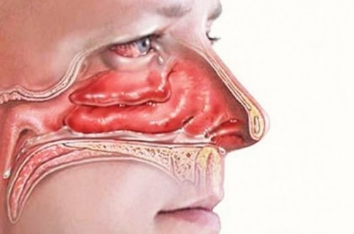 Sağlam ailə – Bu sadə metodun köməyi ilə 2 dəqiqədə burnunuz və nəfəs yollarınız açılacaq ! FOTO+VİDEO