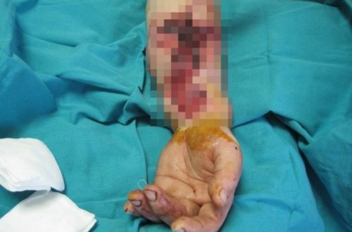 Salyanda DƏHŞƏT! 58 yaşlı kişinin qolu belэ qopdu