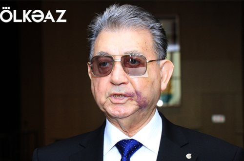 AMEA -nın prezidenti gözündə yaranan problemdən DANIŞDI — EKSKLÜZİV + FOTOLAR