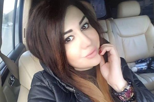 Rəqqasə Fatimənin plastik əməliyyatdan sonra - FOTOLAR