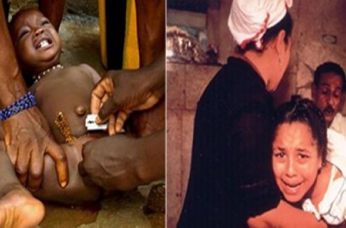 Qadın sünnəti haqqında bilmədiyiniz QORXUNC FAKTLAR