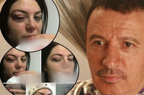 Müğənni həyat yoldaşını ÖLÜMLƏ HƏDƏLƏYİR: 