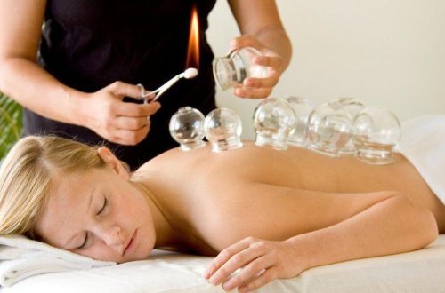 Sən demə, bədənə banka qoymaq olmaz: 